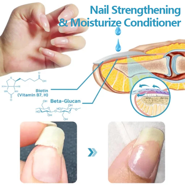 Eelhoe Repair Hand And Foot Cleaning Nail Brightening Care Solution EELHOE COSMETICS