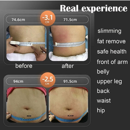 6 in 1 Body U-lipolysis Slimming Machine, Lipo Cavitation for Fat Removal | Skin Tightening Machine, Body Skin Light Spa Care - SD Cosmetics Care