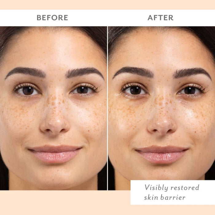 Before and after close-up of a freckled woman with dark hair, her skin looking dewier and more hydrated in the after photo, labeled visibly restored skin barrier.