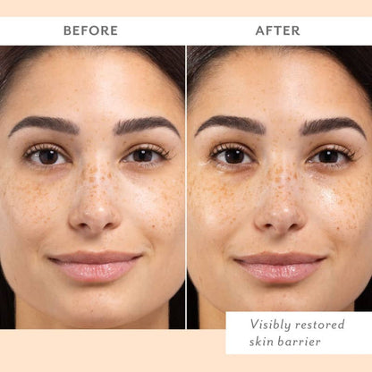 Before and after close-up of a freckled woman with dark hair, her skin looking dewier and more hydrated in the after photo, labeled visibly restored skin barrier.