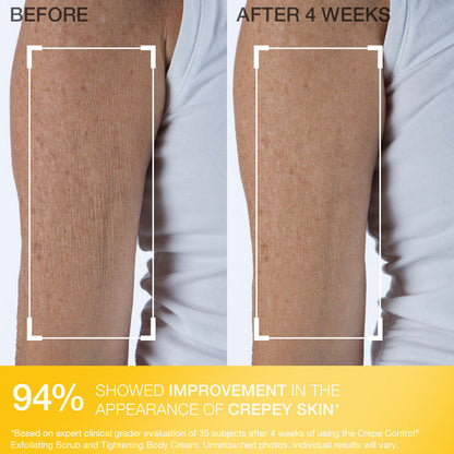Crepe Control® Tightening Body Cream