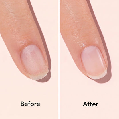 Side-by-side images show a finger’s dry, peeling cuticles before and smooth, healthy cuticles after using Manucurist Day  Night Duo. Each image is labeled to highlight the transformation.