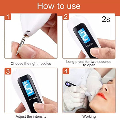 Display Beauty Mole Removal Cautery Pen | Painless Spot Mole Tattoo Wart Speckle Remover Pen Beauty Portable Care Equipment - SD Cosmetics Care