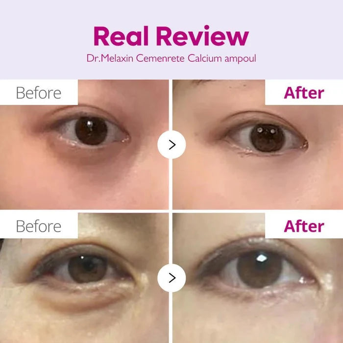 Dr.Melaxin Cemenrete Calcium Intense Ampoule 30 mL