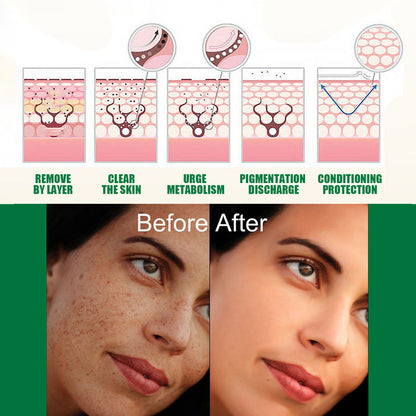 EELHOE Dark Spots Correcting hyperpigmentation Serum Brightening EELHOE COSMETICS
