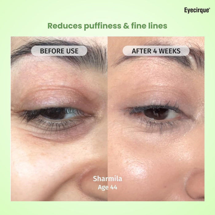 Eyelift Under Eye Gel Cream for Dark Circles, Puffy Eyes, Eye Bags & Wrinkles Pack of 2