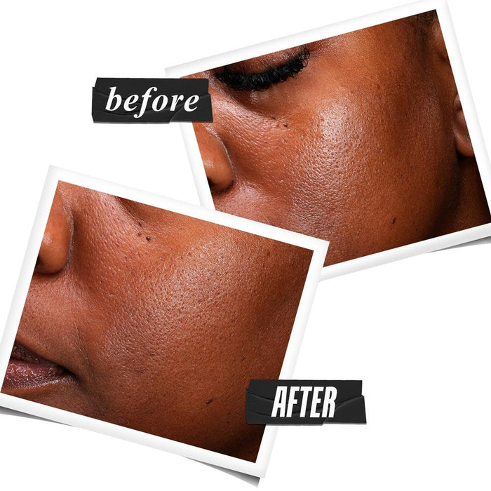 Kiehl's Ultra Pure High-Potency Serum with 5.0% Niacinamide