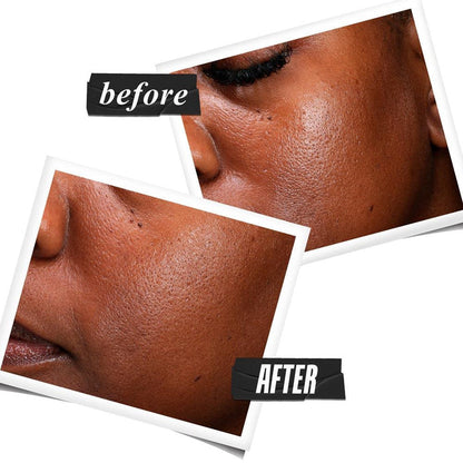 Kiehl's Ultra Pure High-Potency Serum with 5.0% Niacinamide