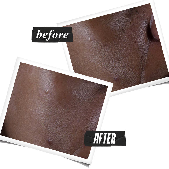 Kiehl's Ultra Pure High-Potency Serum with 9.8% Glycolic Acid