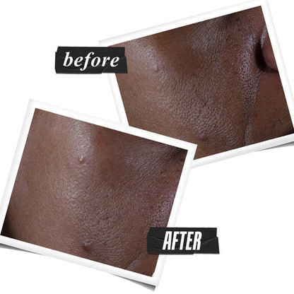 Kiehl's Ultra Pure High-Potency Serum with 9.8% Glycolic Acid