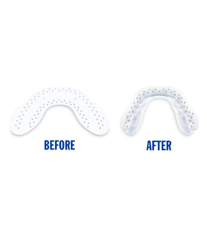 LunaGuard Nighttime Teeth Grinding & Clenching Dental Mouth Guard (10)