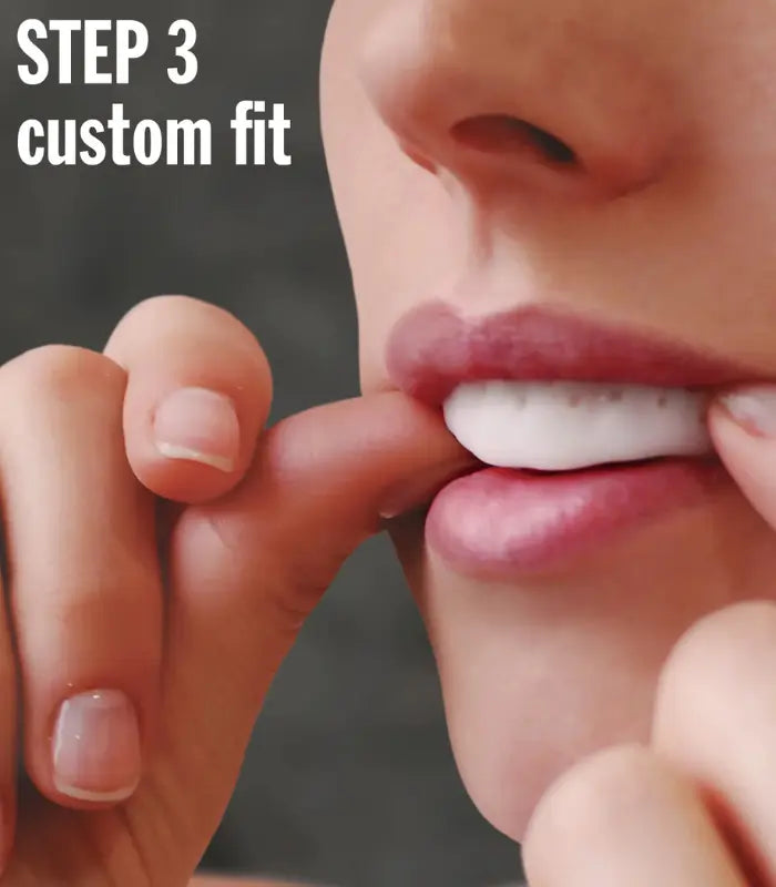 LunaGuard Nighttime Teeth Grinding & Clenching Dental Mouth Guard (8)