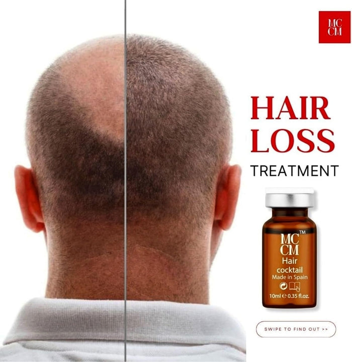 MCCM Hair Cocktail Meso Serums | HAIR Meso REVIVE BOOSTER AMPULE | MCCM HAIR COCKTAILS | HAIR REGROWTH SOLUTIONS (10ML * 5 VIALS) - SD Cosmetics Care