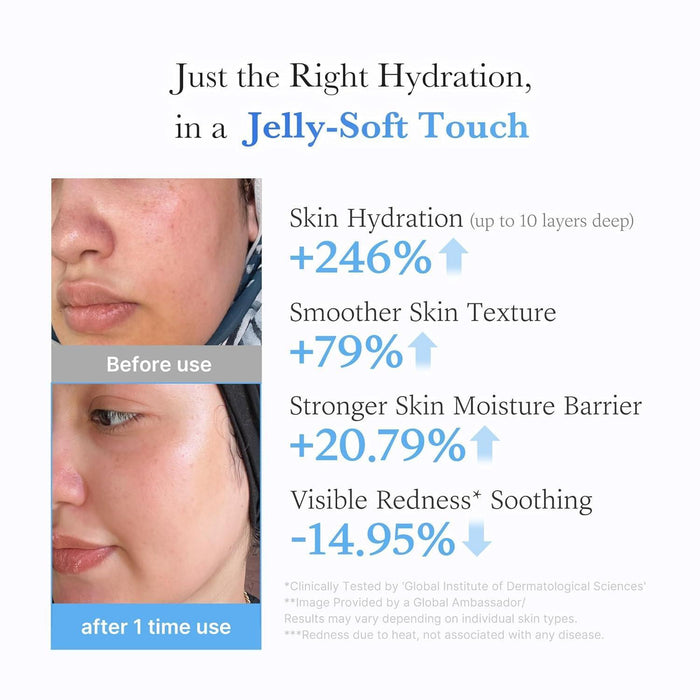 Medicube Hyaluronic Ceramide Jelly Cream 50 mL