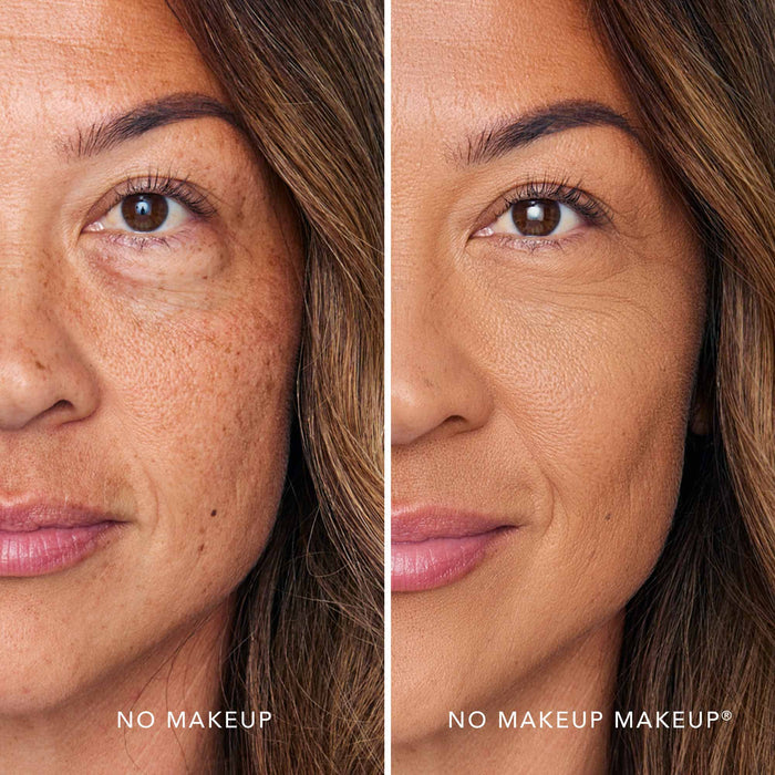 foundation for dark spots hyperpigmentation before after