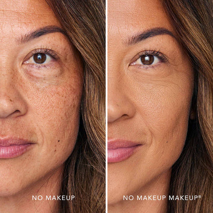 foundation for dark spots hyperpigmentation before after