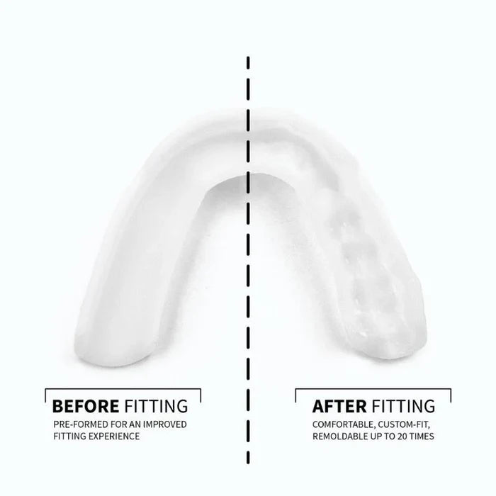 SOVA 3D Night Guard | Teeth Grinding Guard for Moderate Bruxism