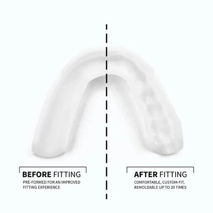 SOVA 3D Night Guard | Teeth Grinding Guard for Moderate Bruxism