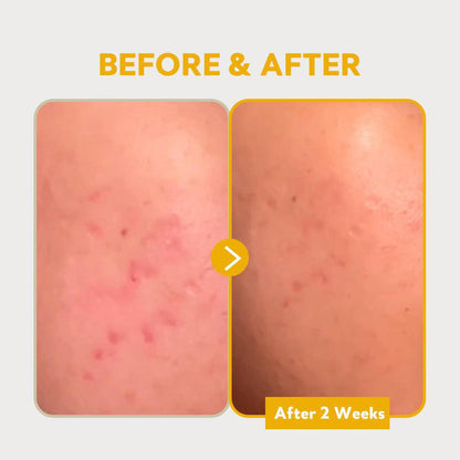 TIRTIR Pure Vitamin C 24% Serum 30 mL