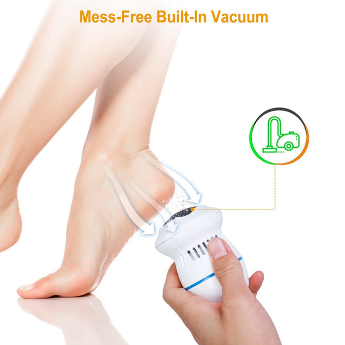 USB Rechargeable Electric Callus Grinder – Vacuum Foot File